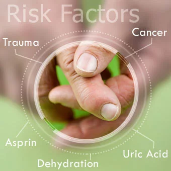 Gout attacks have multiple risk factors that cause uric acid levels to rise.